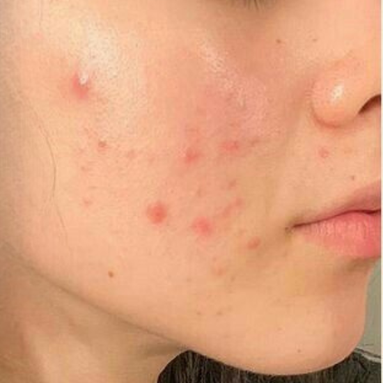 Klean Beauty - Korean Glass Skin Secret